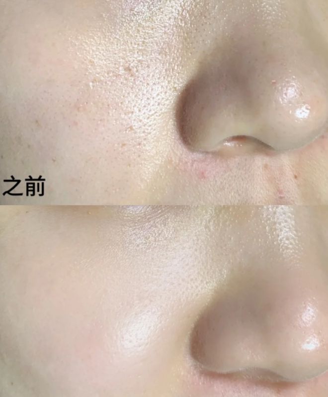 大面膜十大平价好用补水面膜推荐！凯发国际K8国内公认最好用的十(图5)
